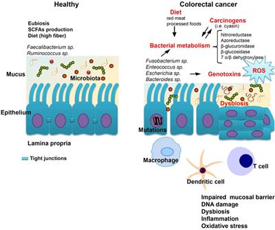 Aspects of Gut Microbiota and Immune System Interactions in Infectious Diseases, Immunopathology, and Cancer